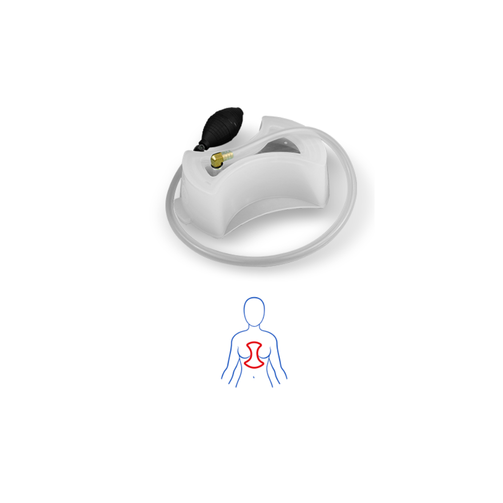 Vacuum PAUHER para pectus excavatum