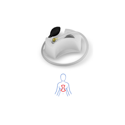 Vacuum PAUHER para pectus excavatum