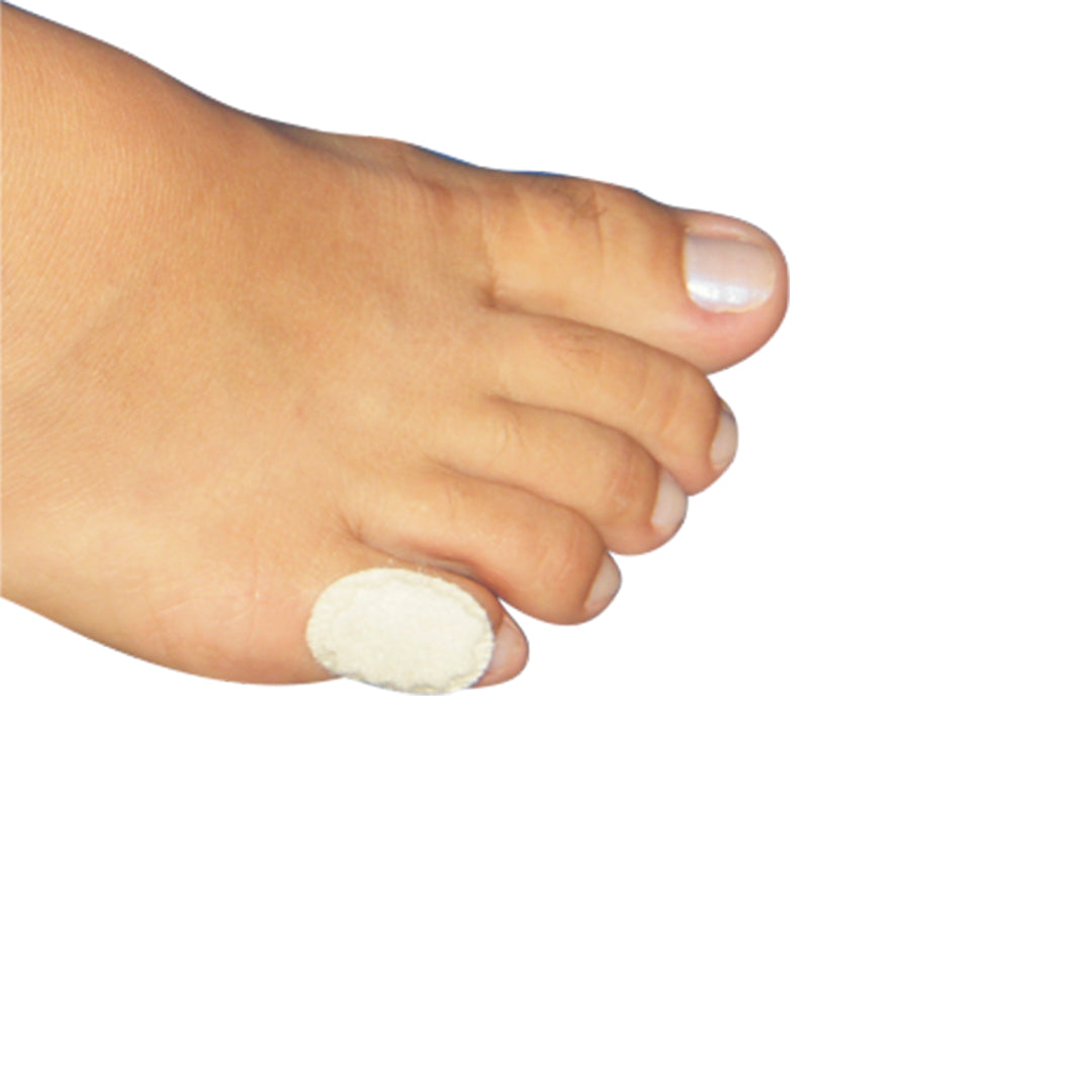 Pé direito utilizando um protetor para calos no pé dedo mindinho.