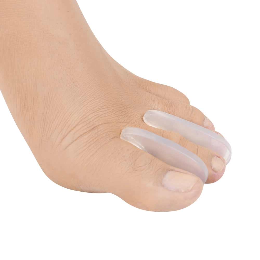 Pé utilizando dois separadores de dedos encaixando entre a primeira e a segunda falange, e a terceira e quarta falange do pé 
